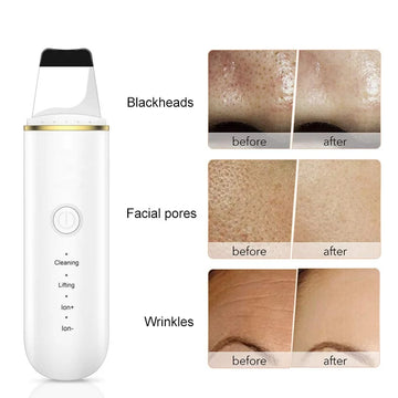 Ultrasonic Skin Scrubber